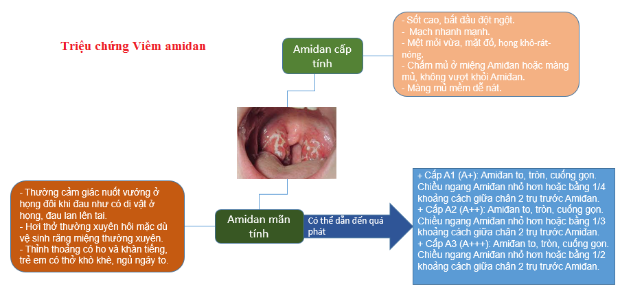 Phương pháp điều trị viêm amidan quá phát
