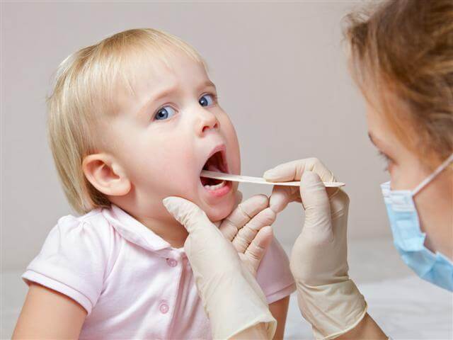 Trường hợp bệnh nhân không nên cắt amidan Trường hợp bệnh nhân không nên cắt amidan