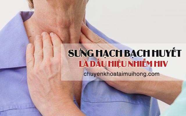 Sưng hạch bạch huyết là dấu hiệu nhiễm HIV