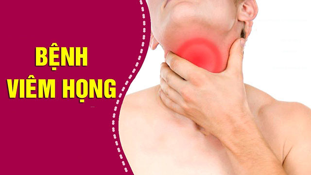 Tìm hiểu về bệnh viêm họng