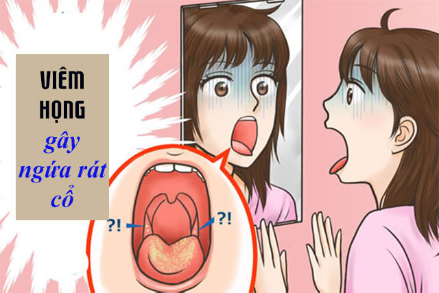 Viêm họng khiến người bệnh bị ngứa rát cổ họng