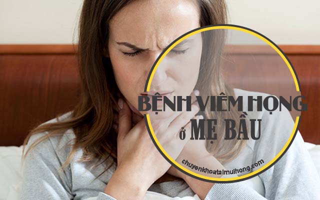 Bệnh viêm họng ở mẹ bầu
