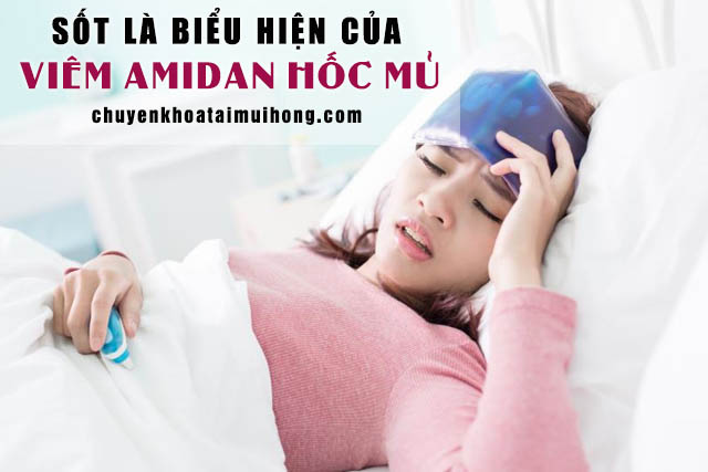 Sốt là biểu hiện của amidan hốc mủ