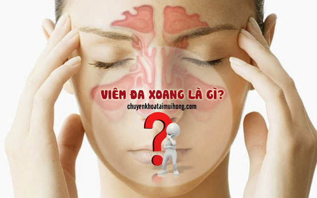 Viêm đa xoang là gì?