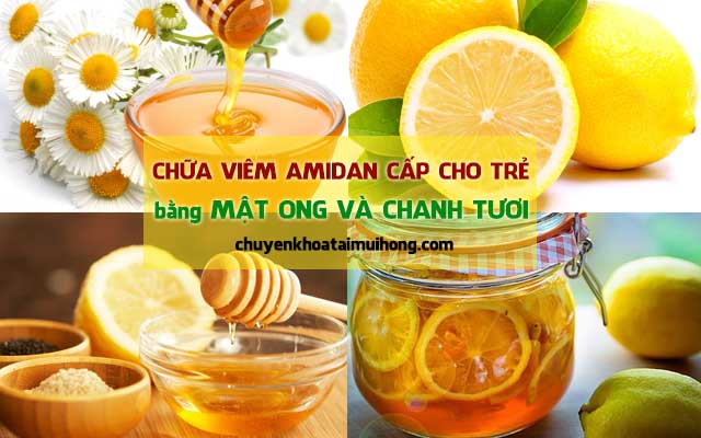 Chữa viêm amidan cấp ở trẻ em bằng mật ong và chanh tươi