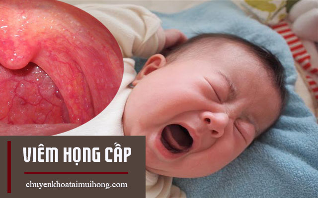 Chữa viêm họng cấp cho trẻ sơ sinh hiệu quả Chữa viêm họng cấp cho trẻ sơ sinh