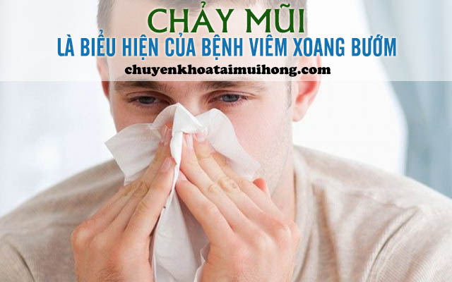 Chảy mũi là dấu hiệu của viêm xoang bướm
