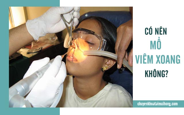 có nên mổ viêm xoang không