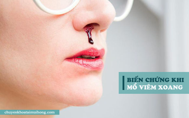 biến chứng mổ viêm xoang