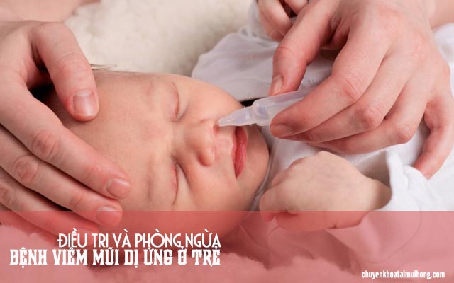 Cách điều trị và phòng ngừa viêm mũi dị ứng ở trẻ