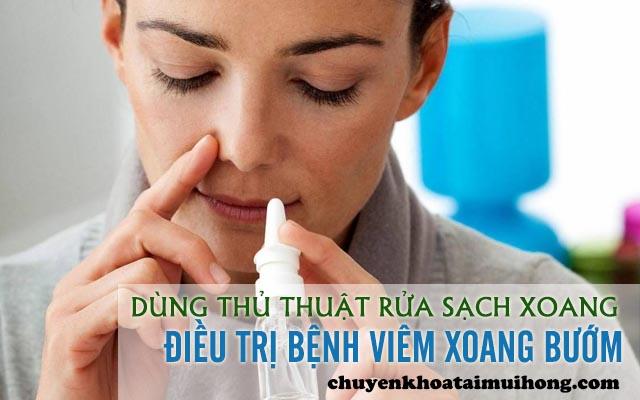 Dùng thủ thuật rửa sạch xoang điều trị viêm xoang bướm