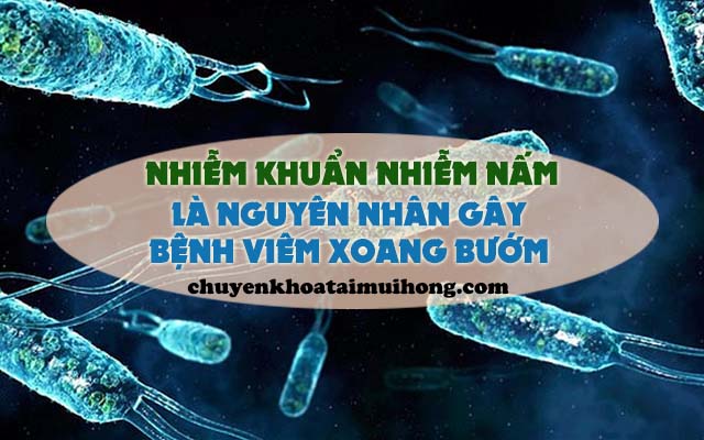 Nguyên nhân gây bệnh viêm xoang bướm