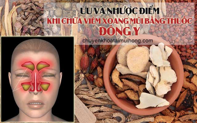 Ưu và nhược điểm của phương pháp chữa viêm xoang bằng thuốc đông y