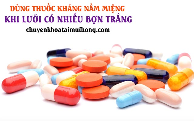 Dùng thuốc kháng nấm miệng khi lưỡi có nhiều bợn trắng