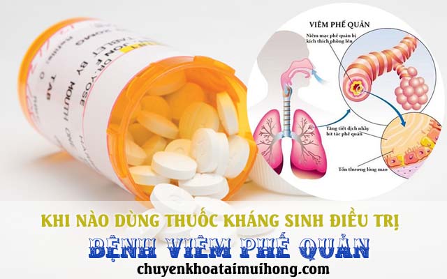 Khi nào nên dùng thuốc kháng sinh chữa viêm phế quản