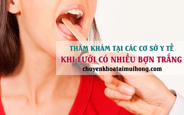 Thăm khám tại các cơ sở y tế khi lưỡi có nhiều bợn trắng