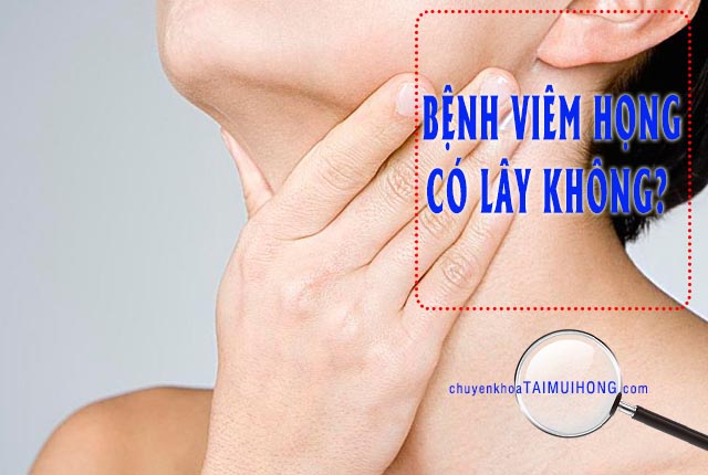 Bệnh viêm họng có lây không?