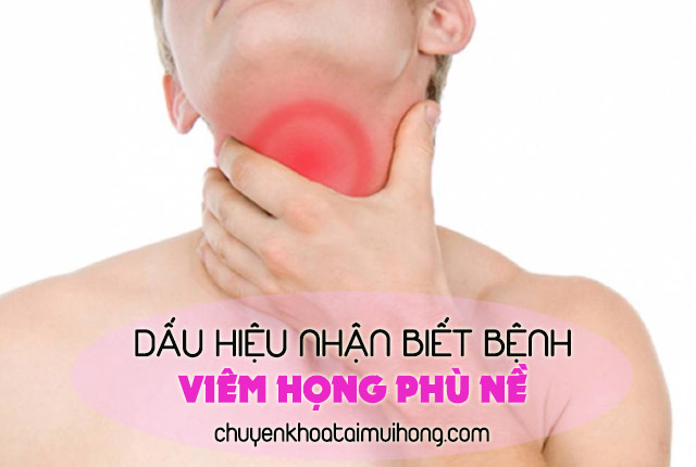 Dấu hiệu nhận biết về bệnh viêm họng phù nề