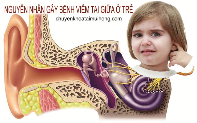 Nguyên nhân gây bệnh viêm tai giữa ở trẻ em 