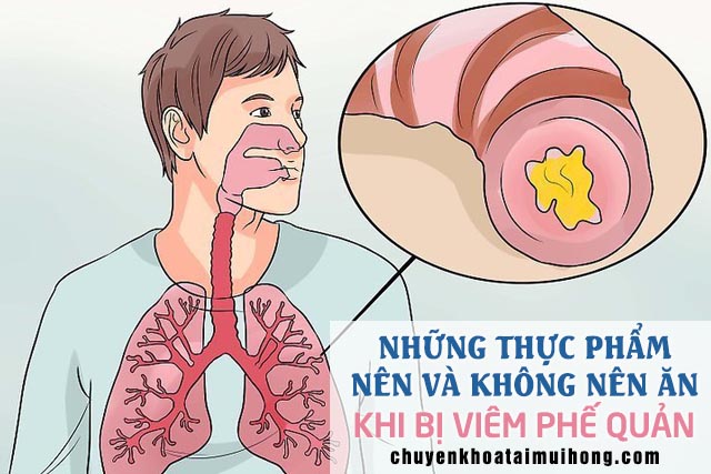 viêm phế quản nên ăn gì và kiêng ăn gì