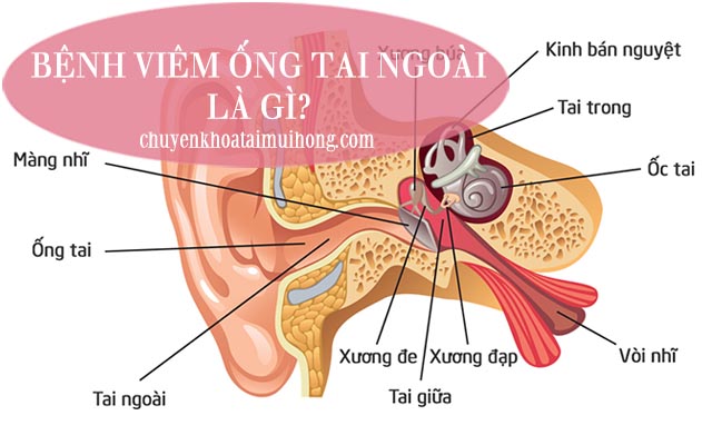 Bệnh viêm ống tai ngoài là gì?