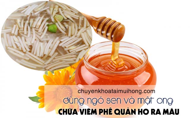 Điều trị viêm phế quản ho ra máu bằng ngó sen và mật ong