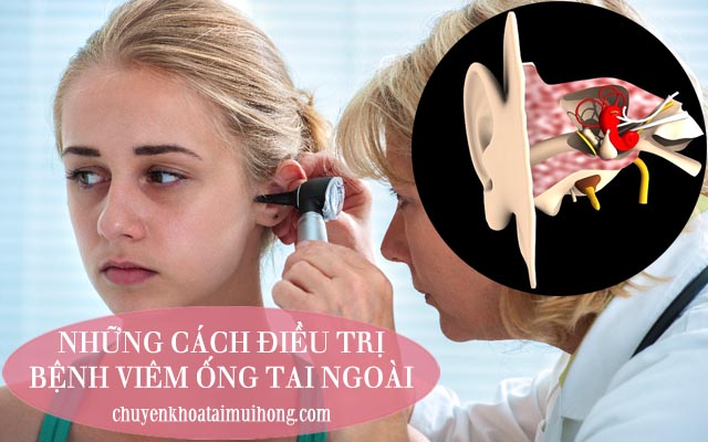 Những cách điều trị bệnh viêm ống tai ngoài