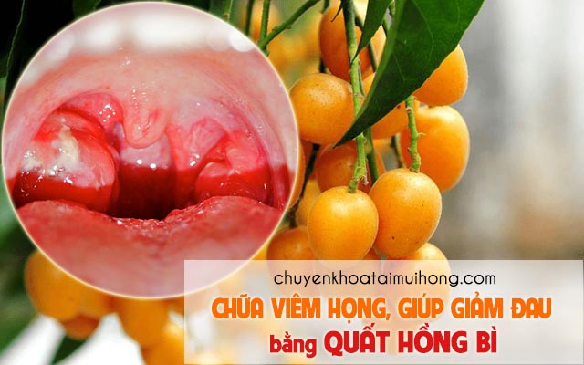 Quất hồng bì chữa viêm họng giúp giảm đau 