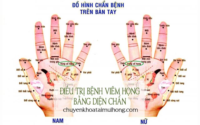 Điều trị viêm họng bằng diện chẩn