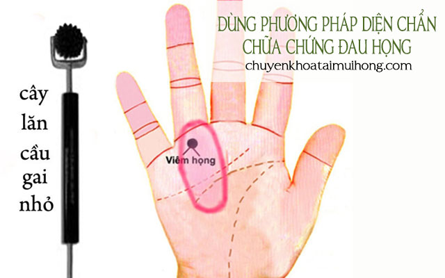 Dùng phương pháp diện chẩn chữa chứng đau họng