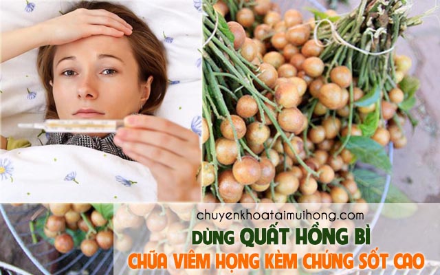 Chữa bệnh viêm họng kèm theo sốt cao bằng quất hồng bì