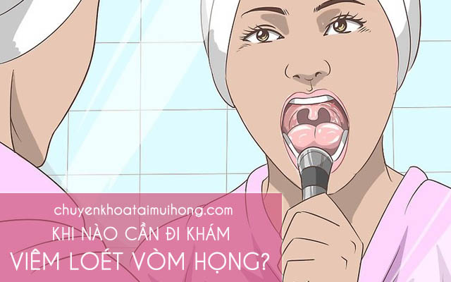 Khi nào cần đi khám viêm loét vòm họng?