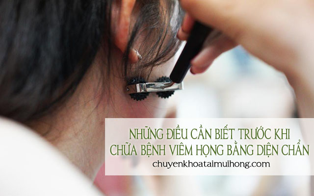 Những điều cần biết trước khi chữa viêm họng bằng diện chẩn