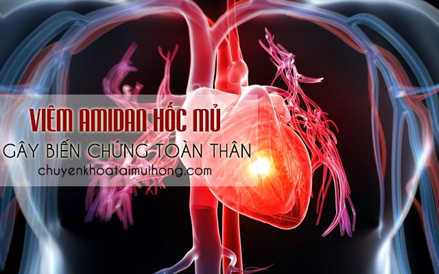 Viêm amidan hốc mủ gây biến chứng toàn thân