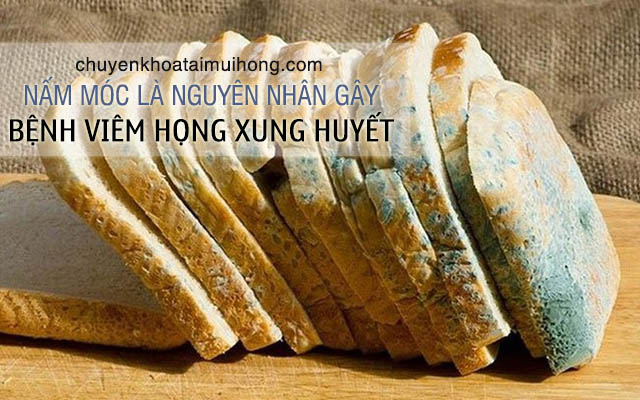 Dị ứng do nấm móc là nguyên nhân dẫn đến viêm họng xung huyết