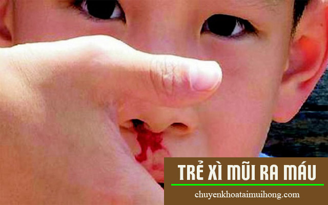 Thận trọng khi trẻ bị xì mũi ra máu