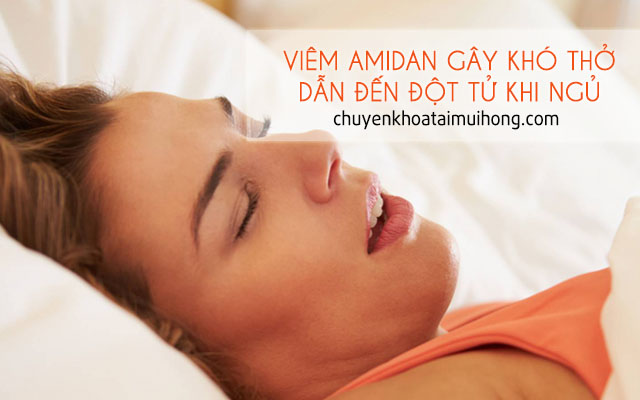 Viêm amidan gây khó thở khiến đột tử khi ngủ