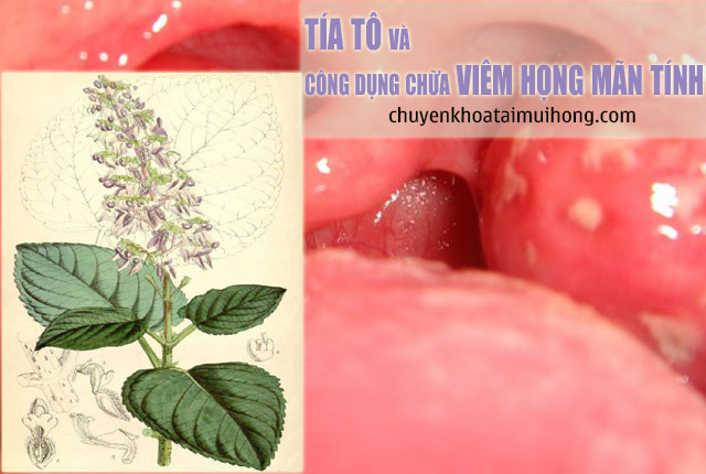 Tía tô và công dụng chữa bệnh viêm họng mãn tính