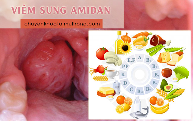 Viêm sưng amidan nên ăn gì và kiêng ăn gì để bệnh nhanh khỏi?