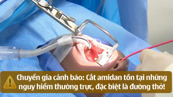 Cần thận trọng trước khi quyết định cắt amidan