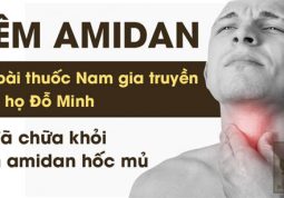 Viêm amidan hốc mủ nhà thuốc Đỗ Minh Đường