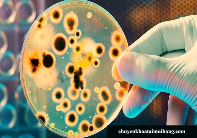 Vi khuẩn gây bệnh viêm phế quản