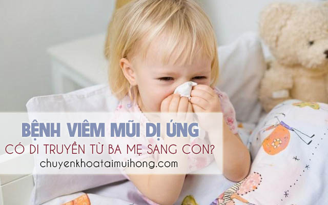 Viêm mũi dị ứng có di truyền không