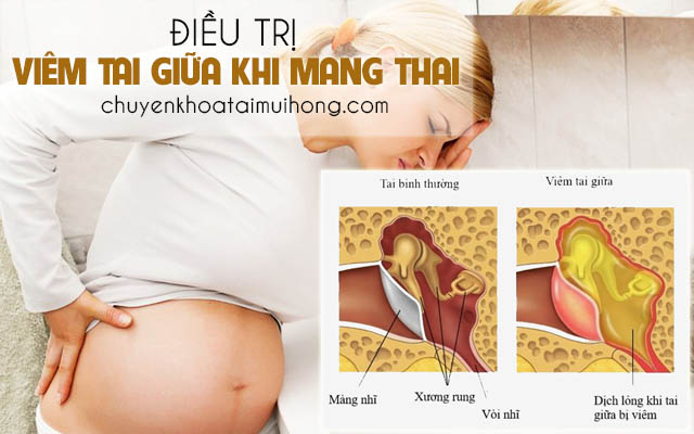 Bị viêm tai giữa khi mang thai nên làm gì?