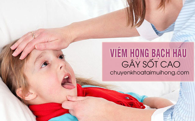 Bệnh viêm họng bạch hầu gây sốt cao