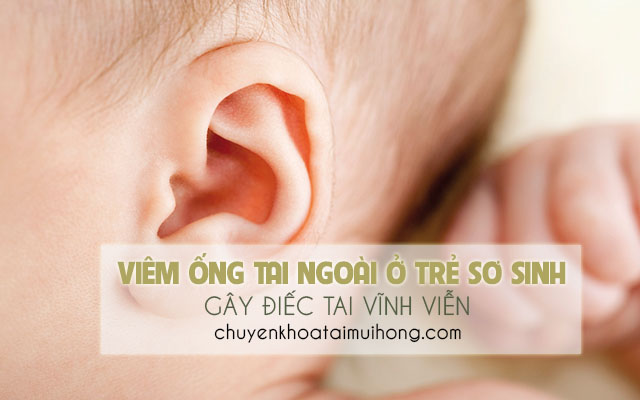 Viêm ống tai ngoài ở trẻ sơ sinh gây điếc tai vĩnh viễn