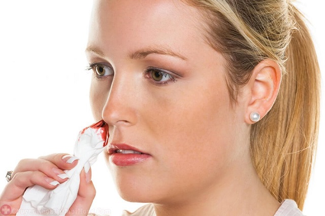 Viêm xoang hỉ mũi ra máu là dấu hiệu bệnh đang phát triển nặng
