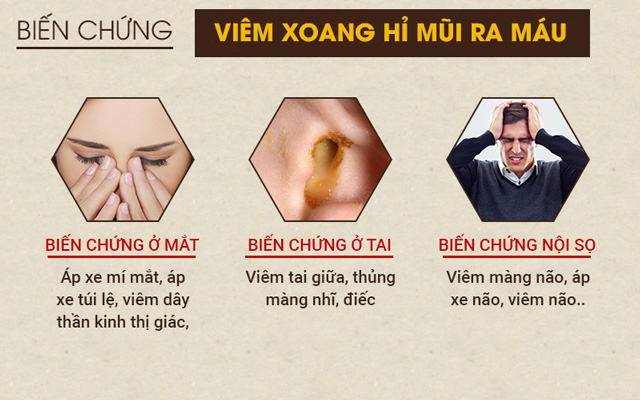 Biến chứng viêm xoang hỉ mũi ra máu