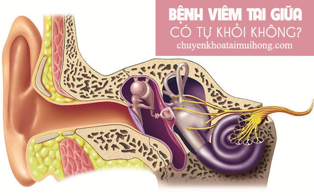 Viêm tai giữa có tự khỏi được không?