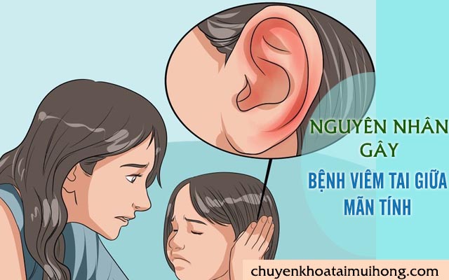 Vì sao mắc bệnh viêm tai giữa mãn tính?